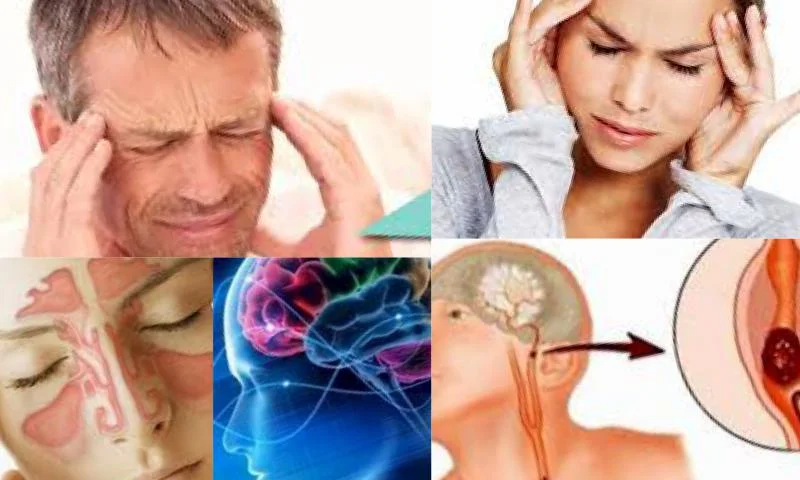 Migrenin Belirtileri Nelerdir