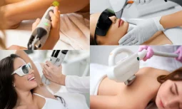Lazer Epilasyon Nedir ve Nasıl Uygulanır?